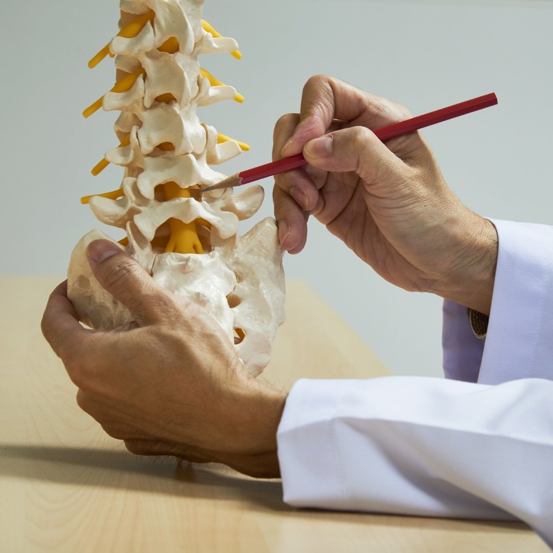 Гемілямінектомія