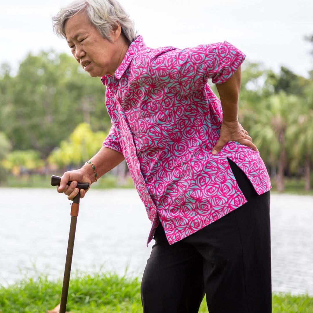 Коксоартроз