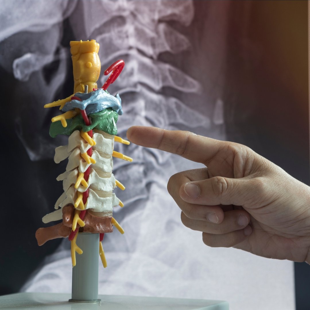 Імпланти для хребта